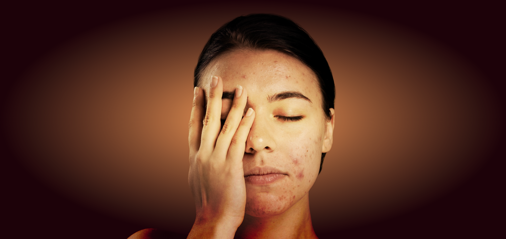 5 Ways to Get Rid of Oily Skin